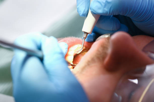 Best Broken Tooth Emergency  in Macdonnell Heights, NY